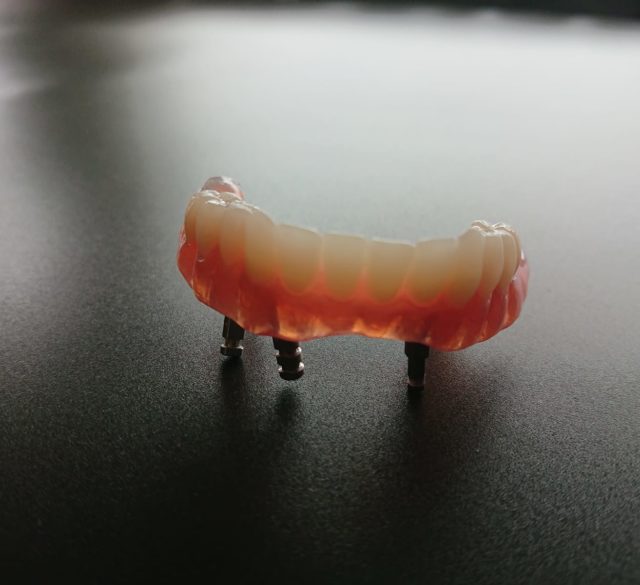 Laborator dentar - laborator tehnica dentara